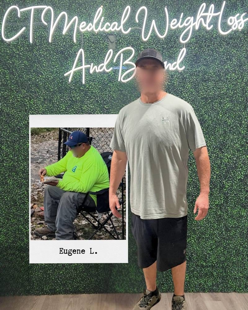 Eugene weight loss results CT Medical Glastonbury CT