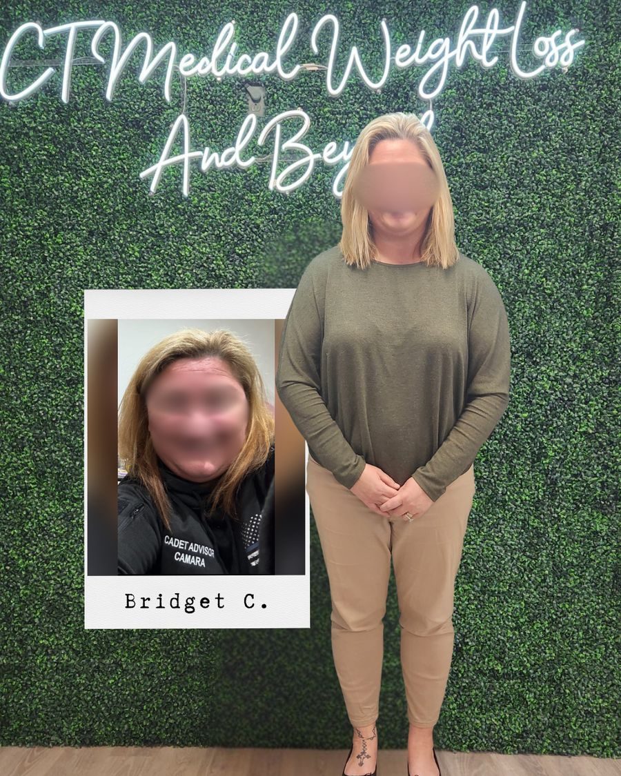 Patient transformation results CT Medical Weight Loss Glastonbury CT