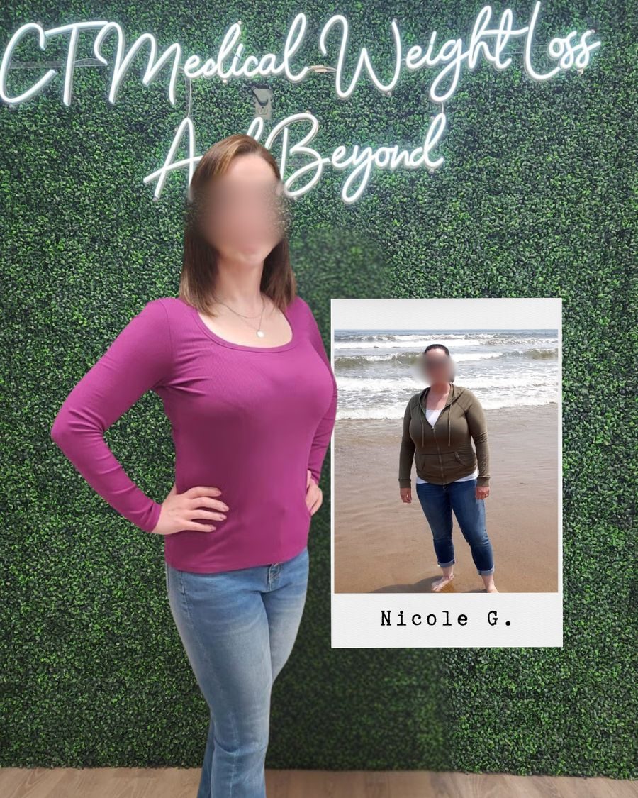 GLP-1 weight loss before and after Glastonbury CT