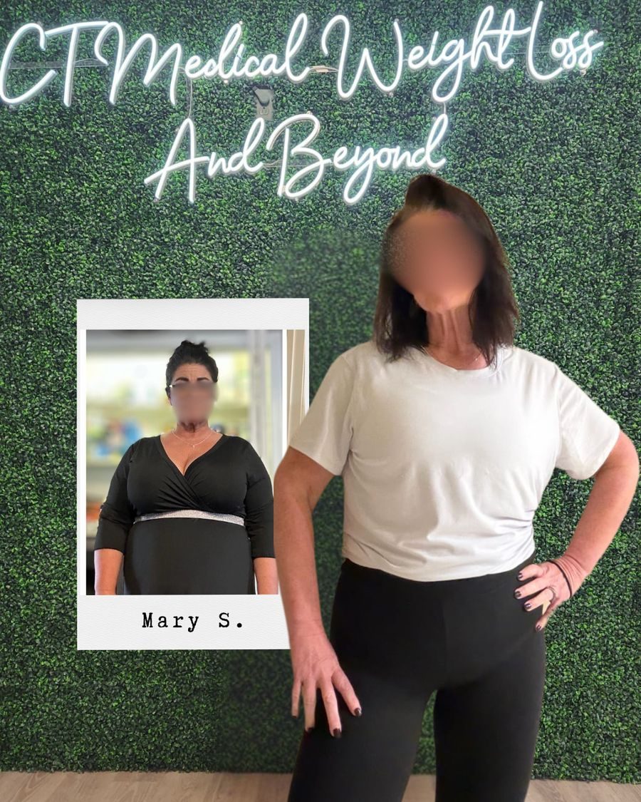 Tirzepatide transformation CT Medical Weight Loss Connecticut