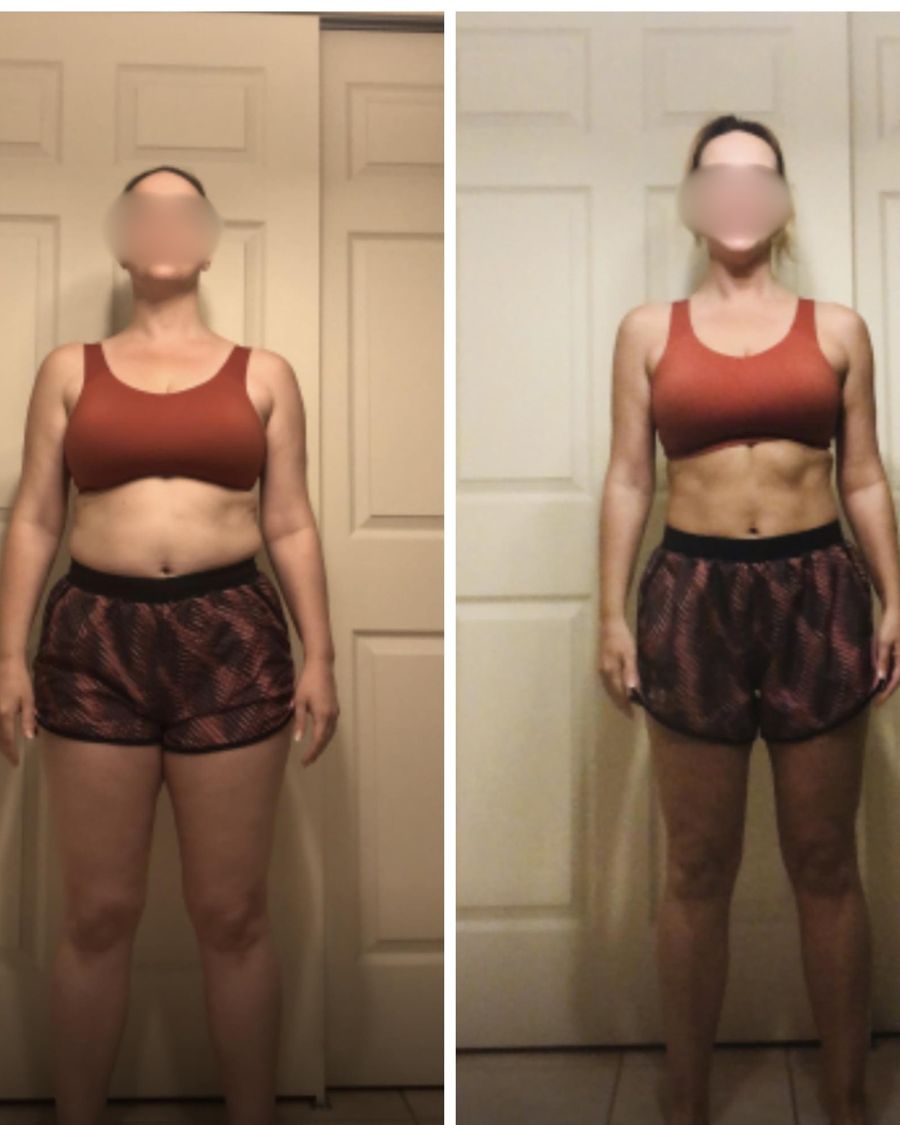 Evolt 360 body composition scanner at CT Medical Weight Loss Glastonbury CT