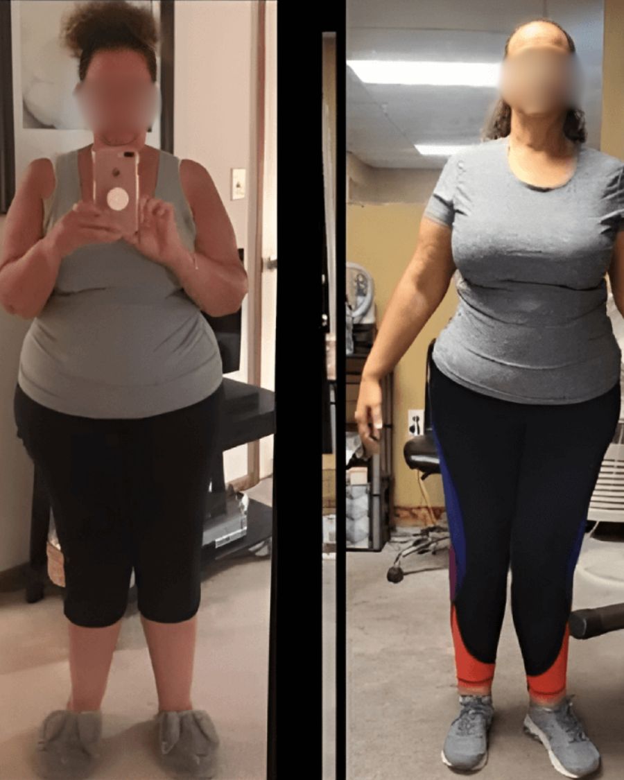 Weight loss transformation CT Medical Weight Loss Glastonbury CT