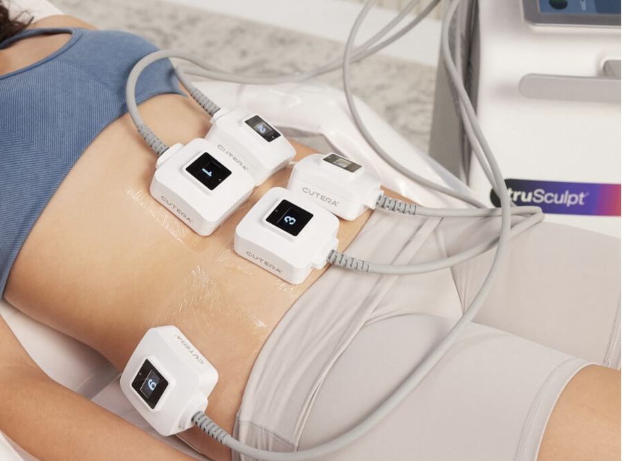 TruSculpt Fat Reduction
